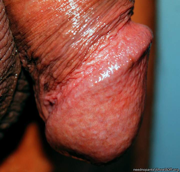 Photo of a dick from neednopants