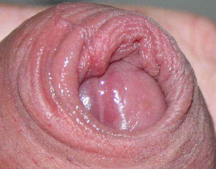Photo of a purple headed monster from nylonlover