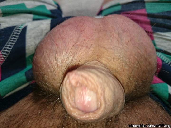 Photo of a short leg from lekkerpikkie
