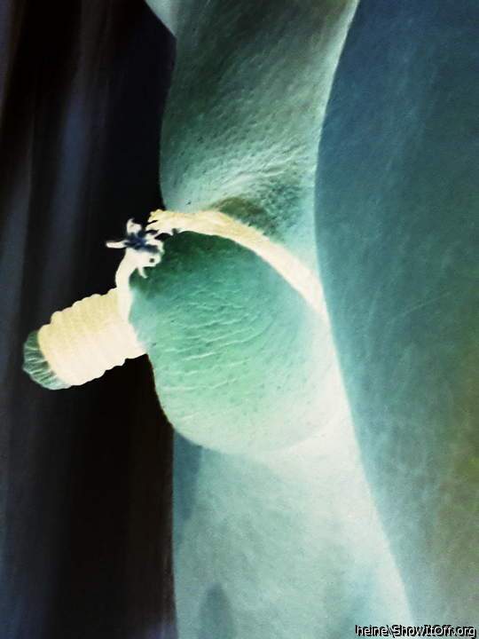 Photo of a dick from heine