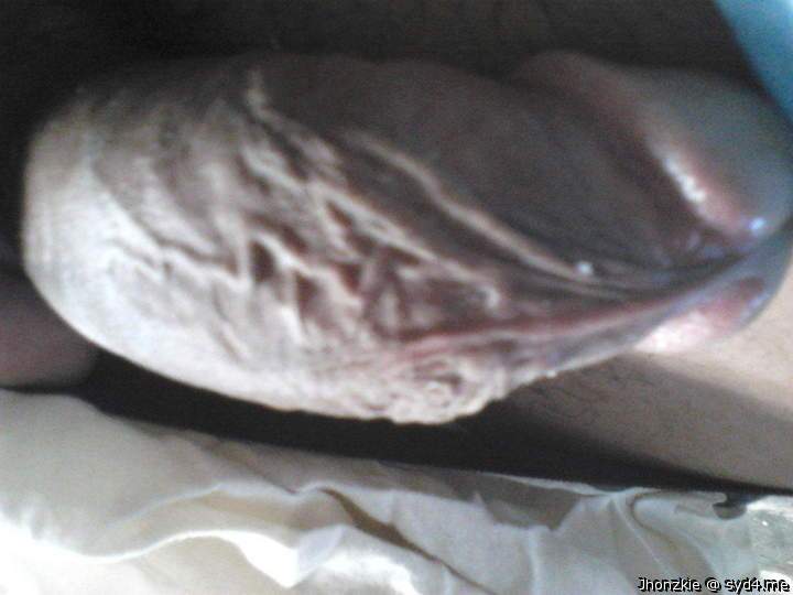 Photo of a love muscle from jhonzkie
