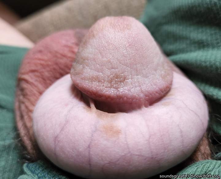 big ring, wrinkled glans