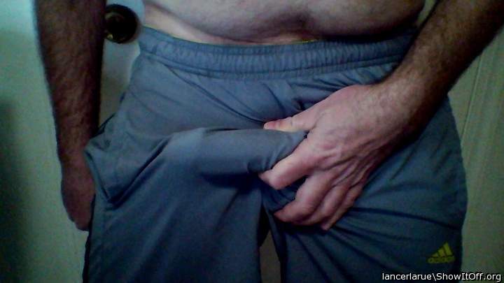 Looks circumcised!! 