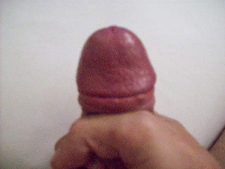 Swollen Head 1