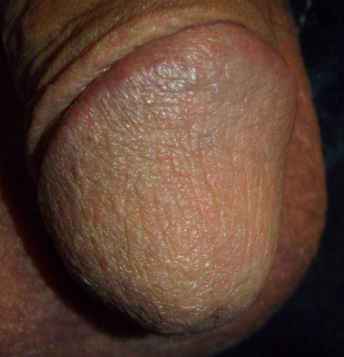 Photo of a bald-headed mouse from lilsoftee