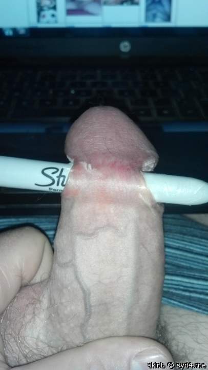 skin bridge