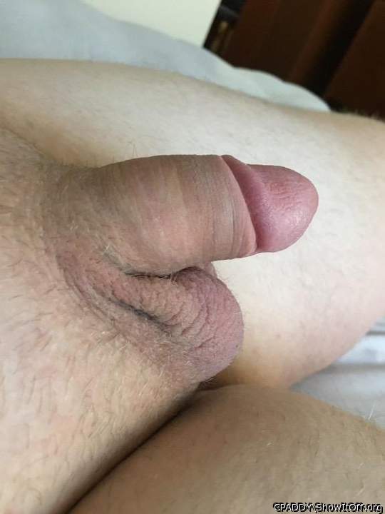 My Circumcised Dick-Do you like it?