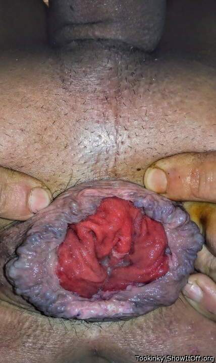 My loose prolapsed ass
