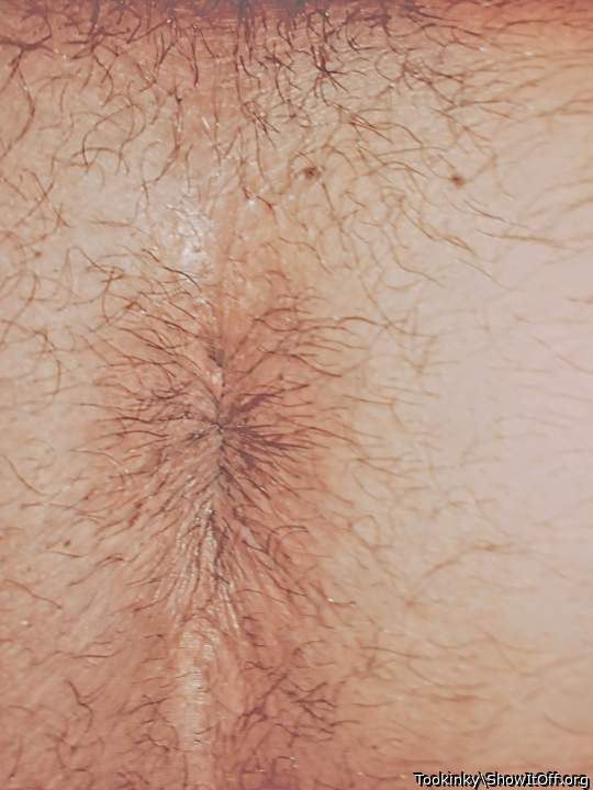 Asshole close up