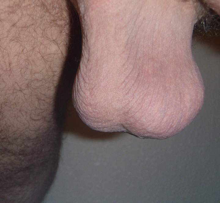 Testicles Photo from lilsoftee