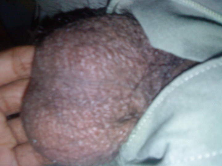Testicles Photo from nicedices