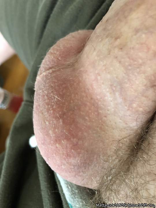 Testicles Photo from Mattatuck06705