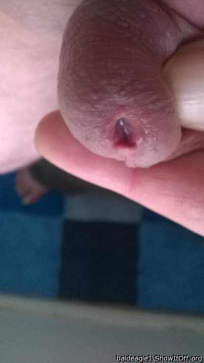 Photo of a phallus from baldeagle1