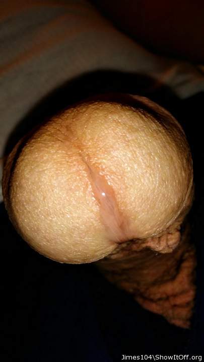Photo of a penis from jimes104