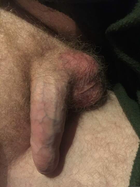 Photo of a phallus from peter79