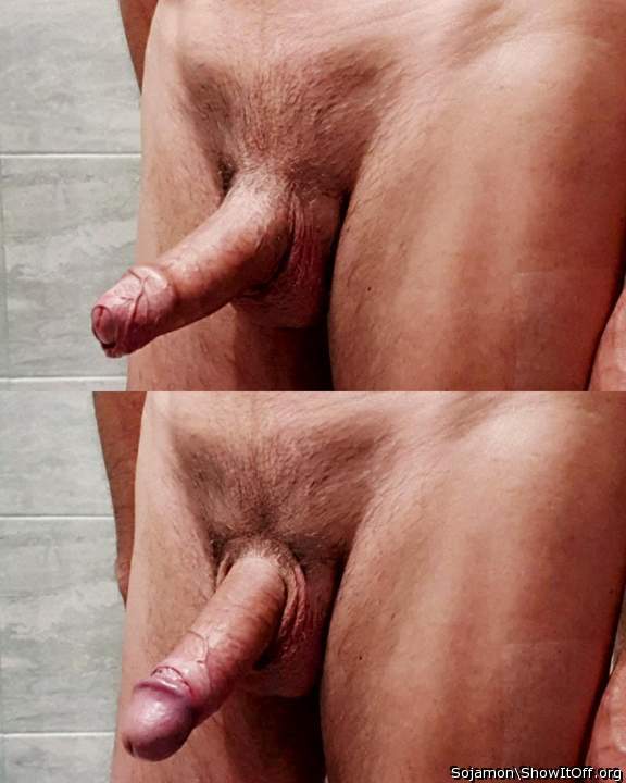 splendid dialogue 
between folded foreskin and retracted fo