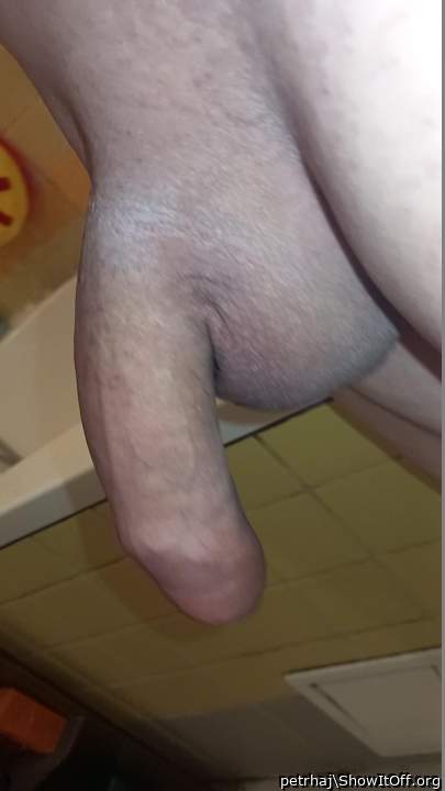 my dick normal