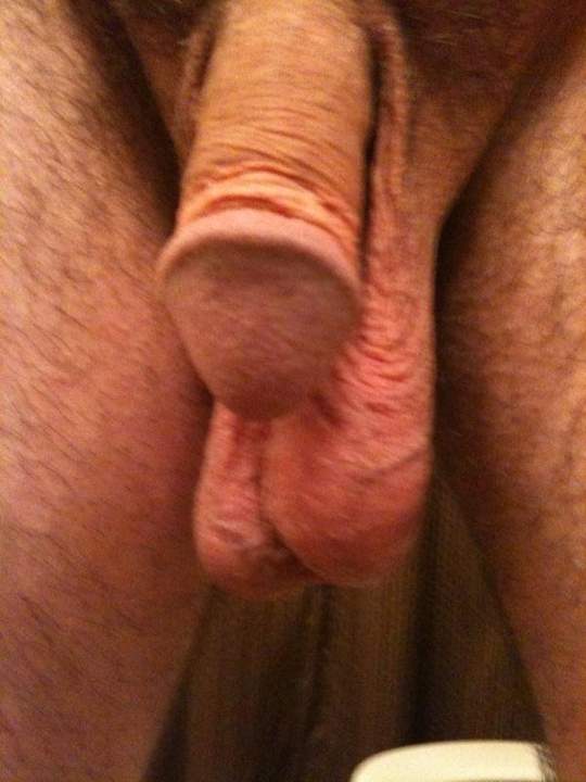 Testicles Photo from bdguy