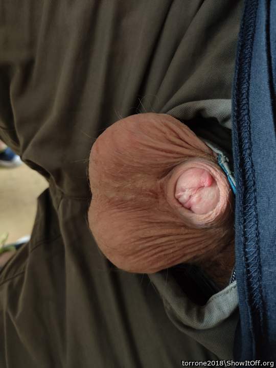 Photo of a penis from torrone2018