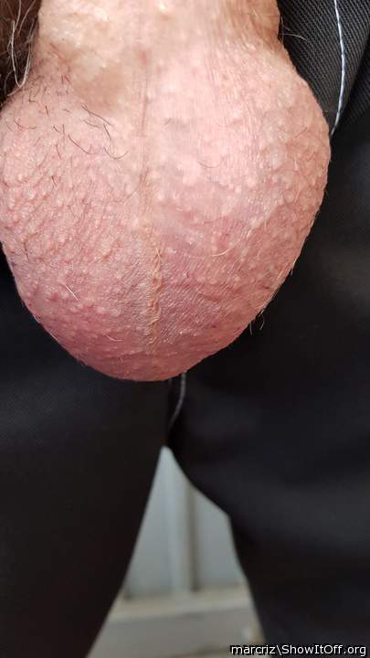 Super testicoli