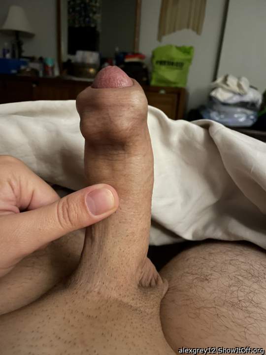 Marbles in my foreskin lol