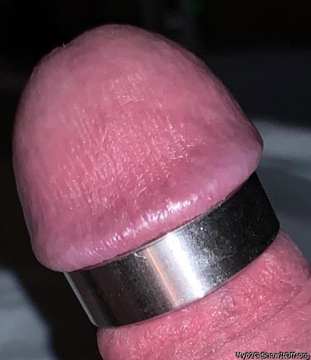 Photo of a penis from My62C