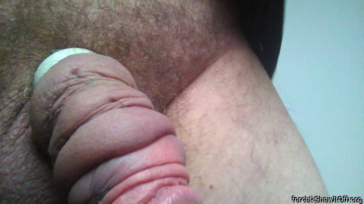 Photo of a penile from forcbt