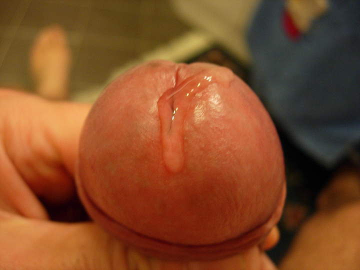 Photo of a middle leg from roccotano