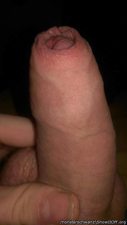 semi foreskin
