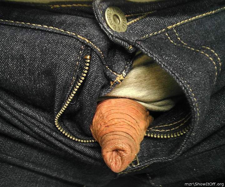 The tip of the foreskin on my uncircumcised dick