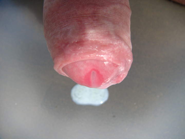 Photo of a bald-headed mouse from sivad666