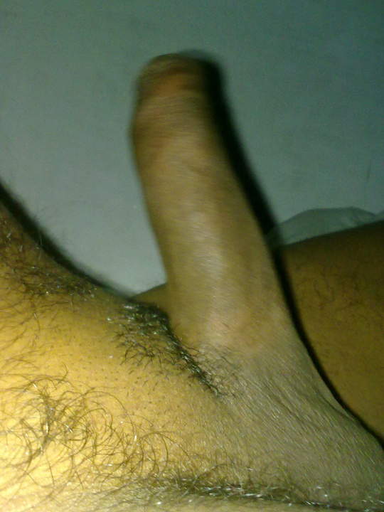 Photo of a one-eyed monster from sexbaba2111