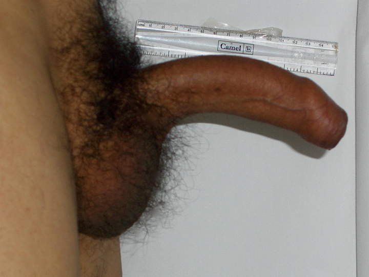 Photo of a wiener from dickmaster
