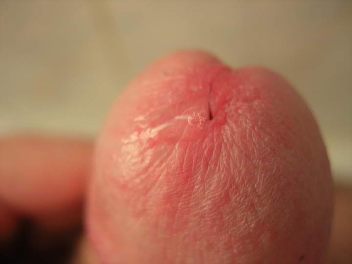 Photo of a thing from winger70