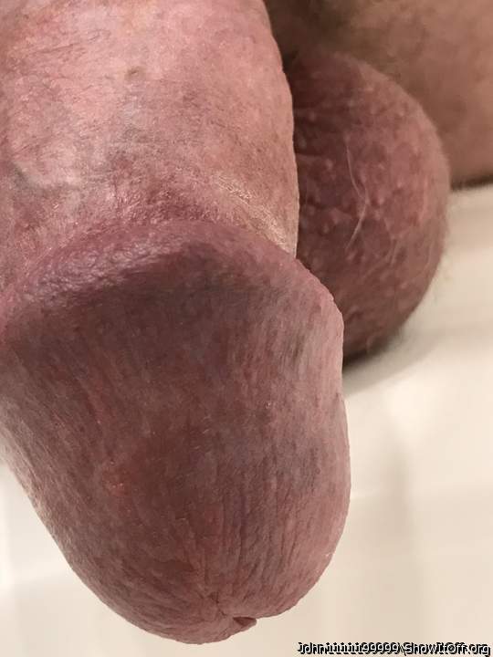 Photo of a prick from John1111199999