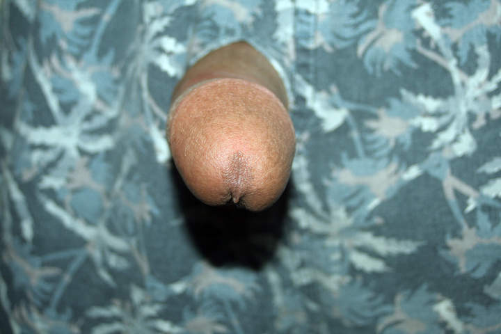 Photo of a purple headed monster from Anass