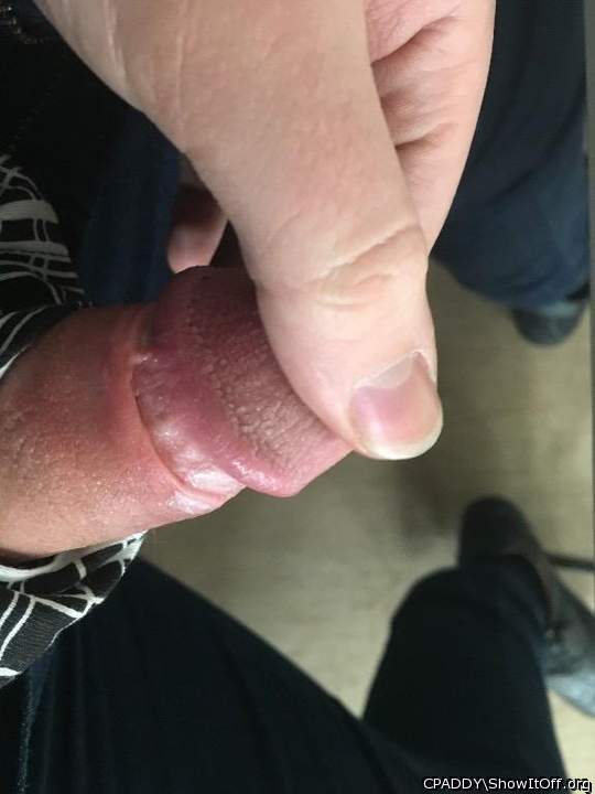 My Circumcised Dick-Do you like it?