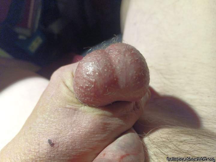 Testicles Photo from Ballistica