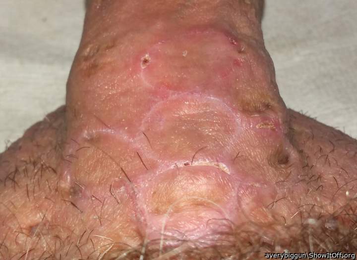 12 Days after Branding