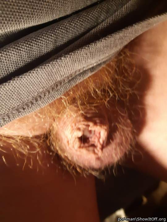 Red and hairy