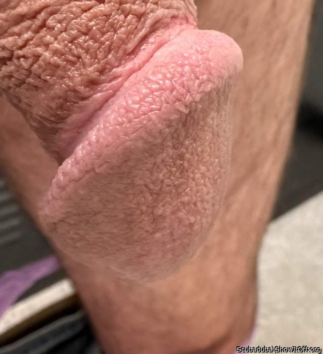 Circumcised, and dried to perfection   