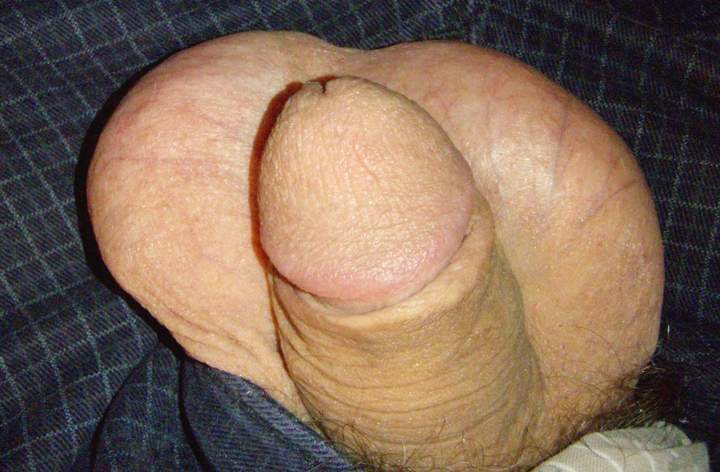 Testicles Photo from lilsoftee