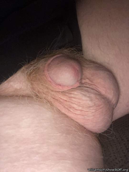 Testicles Photo from williamsch