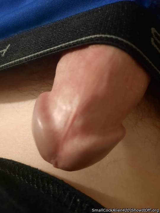 Photo of a penis from SmallCockAlien420