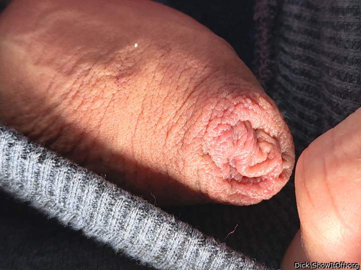 Photo of a prick from Dick