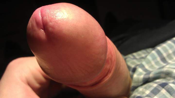 Photo of a prick from Vanillacum