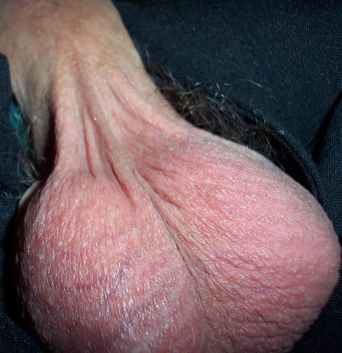 Testicles Photo from lilsoftee