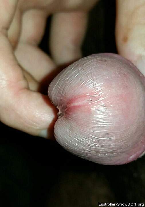 Photo of a short leg from *Humpy_Rugmuncher