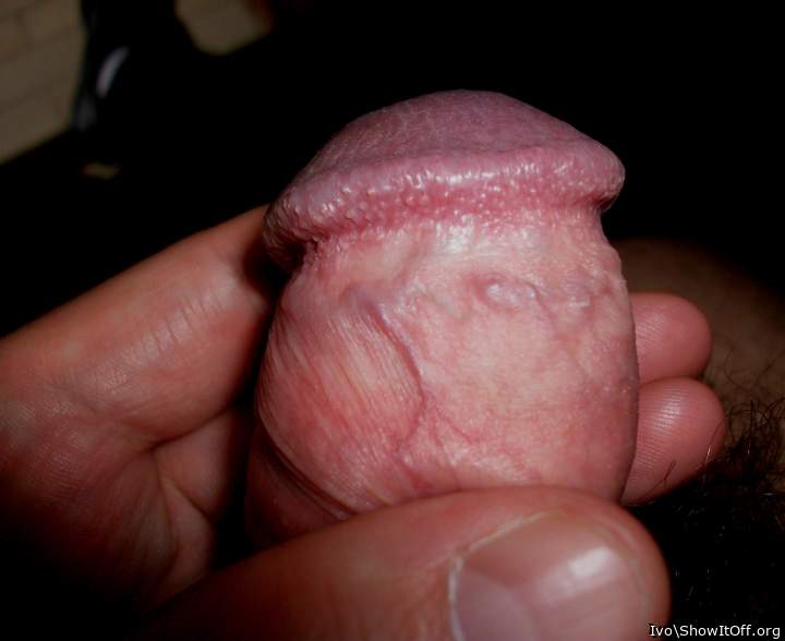 Glans closeup with corona and retracted foreskin