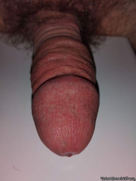 Photo of a penile from Cbtbc